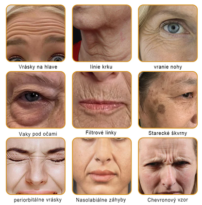 🔥Sinvie® regeneračný krém s včelím jedom | 50 ml | Odporúčaný Slovenskou dermatovenerologickou spoločnosťou