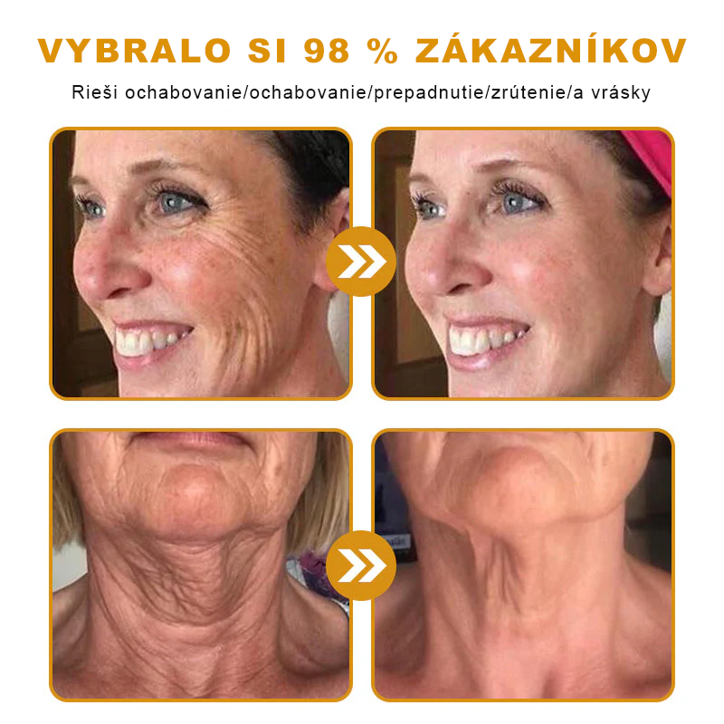 🔥Sinvie® regeneračný krém s včelím jedom | 50 ml | Odporúčaný Slovenskou dermatovenerologickou spoločnosťou