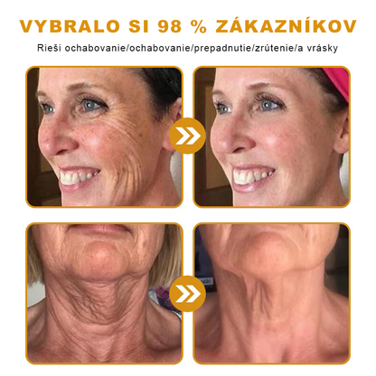 🔥Sinvie® regeneračný krém s včelím jedom | 50 ml | Odporúčaný Slovenskou dermatovenerologickou spoločnosťou