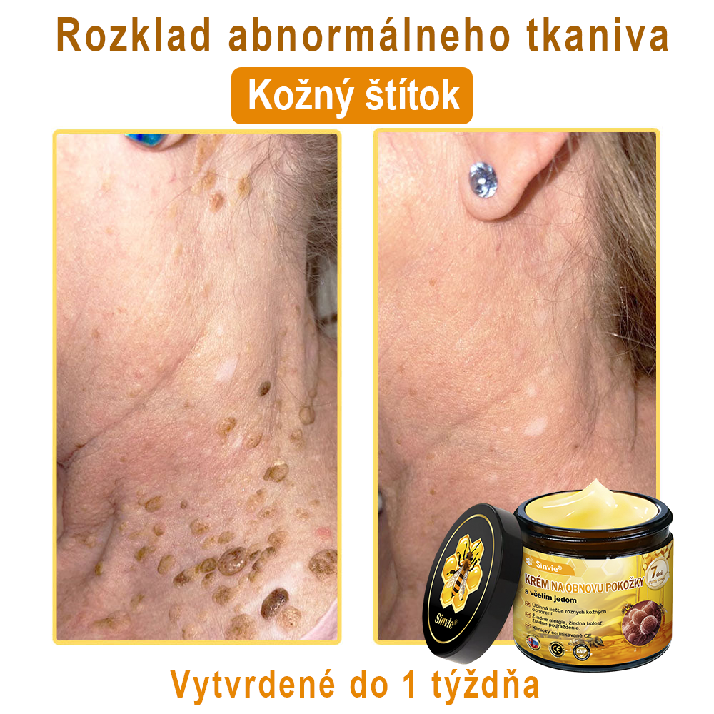 🔥Sinvie® regeneračný krém s včelím jedom | 50 ml | Odporúčaný Slovenskou dermatovenerologickou spoločnosťou
