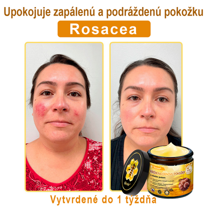🔥Sinvie® regeneračný krém s včelím jedom | 50 ml | Odporúčaný Slovenskou dermatovenerologickou spoločnosťou