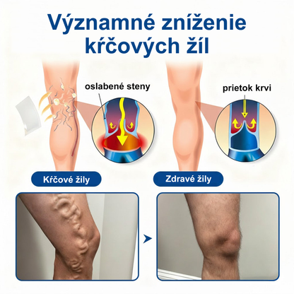 👨‍⚕️✅ Medistart® VeinRepair – mikroihličková ošetrujúca náplasť ⚡ Okamžitá úľava, dlhotrvajúci výsledok