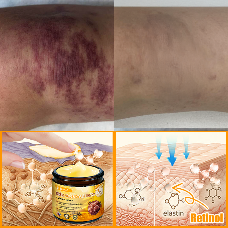 🔥Sinvie® regeneračný krém s včelím jedom | 50 ml | Odporúčaný Slovenskou dermatovenerologickou spoločnosťou