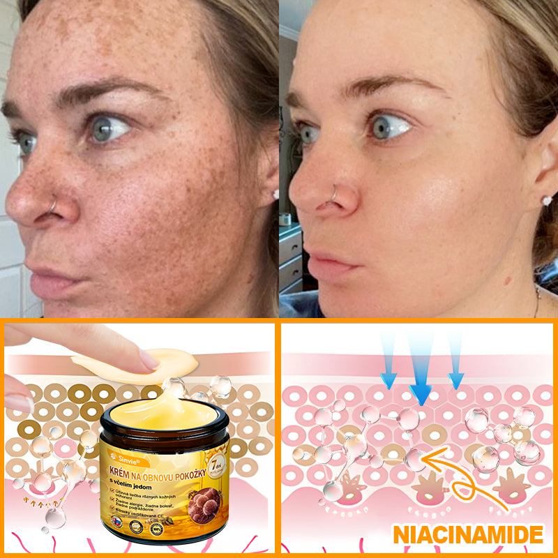 🔥Sinvie® regeneračný krém s včelím jedom | 50 ml | Odporúčaný Slovenskou dermatovenerologickou spoločnosťou