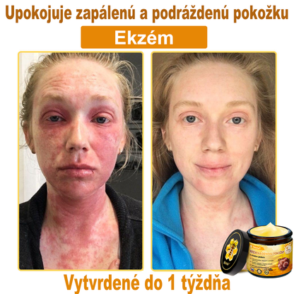 🔥Sinvie® regeneračný krém s včelím jedom | 50 ml | Odporúčaný Slovenskou dermatovenerologickou spoločnosťou