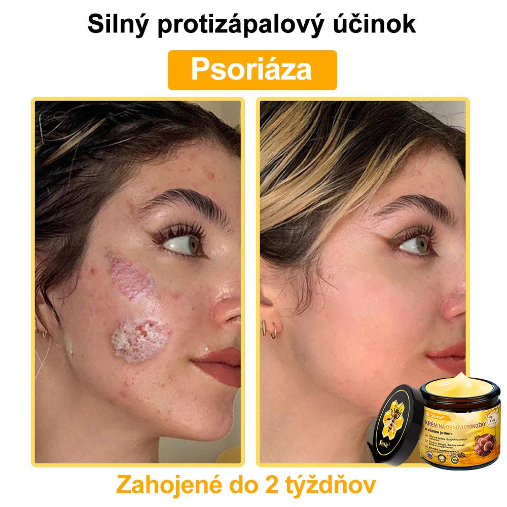 🔥Sinvie® regeneračný krém s včelím jedom | 50 ml | Odporúčaný Slovenskou dermatovenerologickou spoločnosťou
