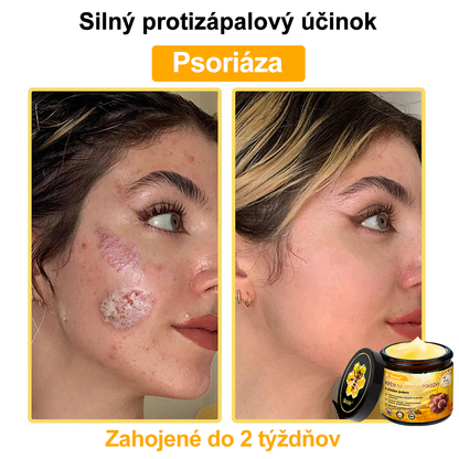 🔥Sinvie® regeneračný krém s včelím jedom | 50 ml | Odporúčaný Slovenskou dermatovenerologickou spoločnosťou