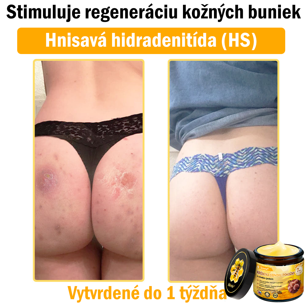 🔥Sinvie® regeneračný krém s včelím jedom | 50 ml | Odporúčaný Slovenskou dermatovenerologickou spoločnosťou