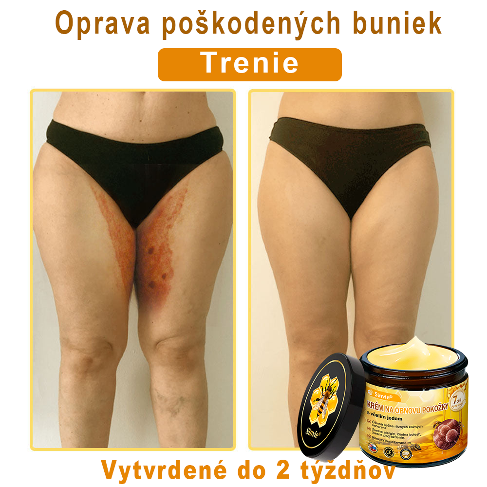 🔥Sinvie® regeneračný krém s včelím jedom | 50 ml | Odporúčaný Slovenskou dermatovenerologickou spoločnosťou