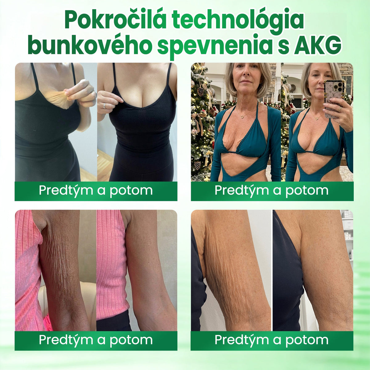 🔥🔥Medistart® SPEVŇUJÚCA & PROTI STARNUTIU PLEŤOVÁ STAROSTLIVOSŤ
