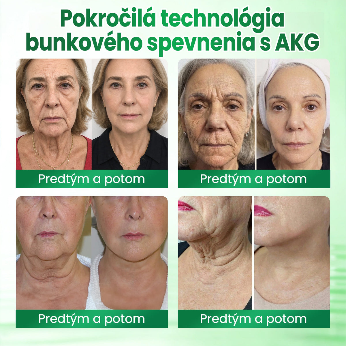🔥🔥Medistart® SPEVŇUJÚCA & PROTI STARNUTIU PLEŤOVÁ STAROSTLIVOSŤ