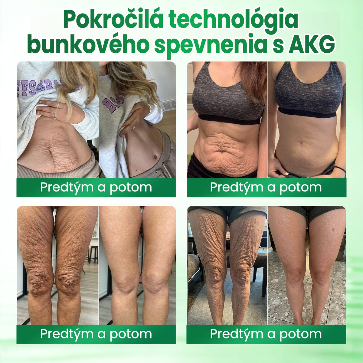 🔥🔥Medistart® SPEVŇUJÚCA & PROTI STARNUTIU PLEŤOVÁ STAROSTLIVOSŤ