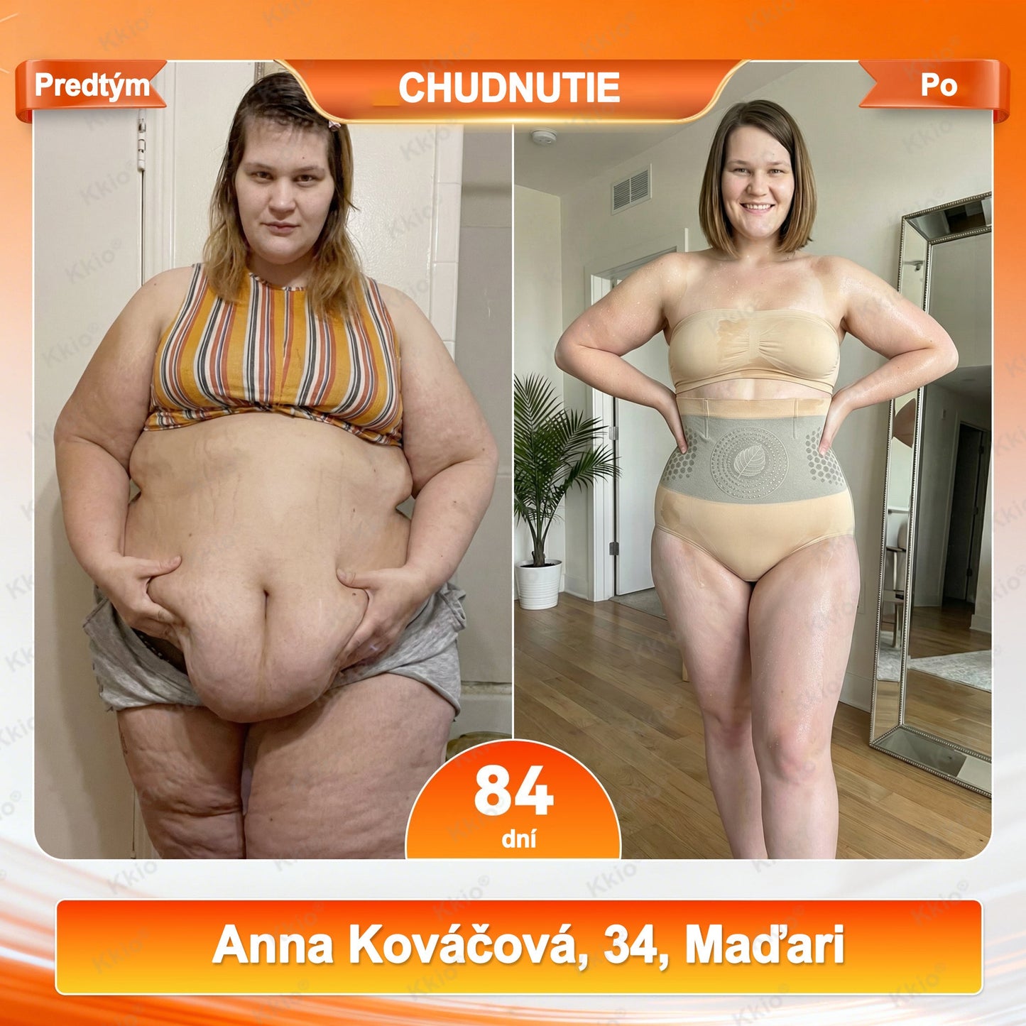🔥🔥👖 Objavte tajomstvo – Kkio® 4 v 1 tvarovacie a spaľovačské kraťasy s mikronizovanou moringou a borberínom ☘️ Výhradne v oficiálnom e-shope značky.