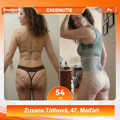 🔥🔥👖 Objavte tajomstvo – Kkio® 4 v 1 tvarovacie a spaľovačské kraťasy s mikronizovanou moringou a borberínom ☘️ Výhradne v oficiálnom e-shope značky.